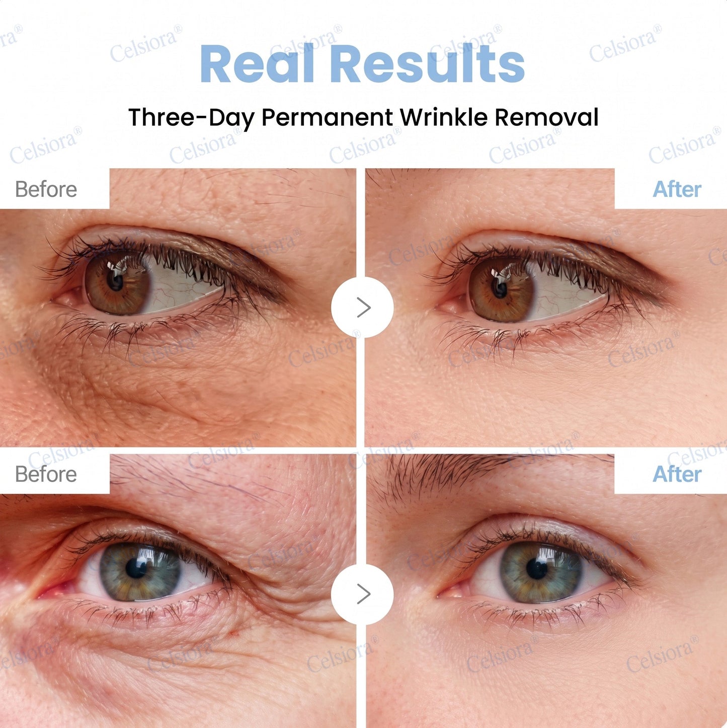 🔵🟦UK HOT SALE Celsiora® PDRN Anti-Wrinkle Shot – Lift & Firming Cream