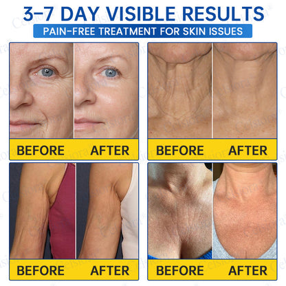 🔵🟦UK HOT SALE Celsiora® PDRN Anti-Wrinkle Shot – Lift & Firming Cream