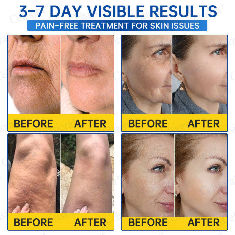 🔵🟦UK HOT SALE Celsiora® PDRN Anti-Wrinkle Shot – Lift & Firming Cream