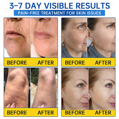 🔵🟦UK HOT SALE Celsiora® PDRN Anti-Wrinkle Shot – Lift & Firming Cream
