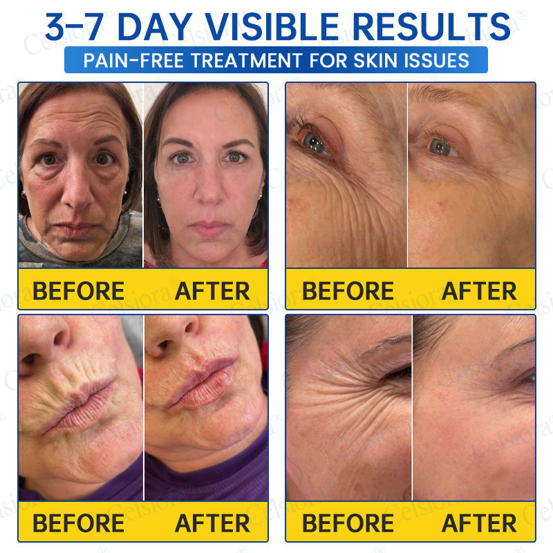 🔵🟦UK HOT SALE Celsiora® PDRN Anti-Wrinkle Shot – Lift & Firming Cream