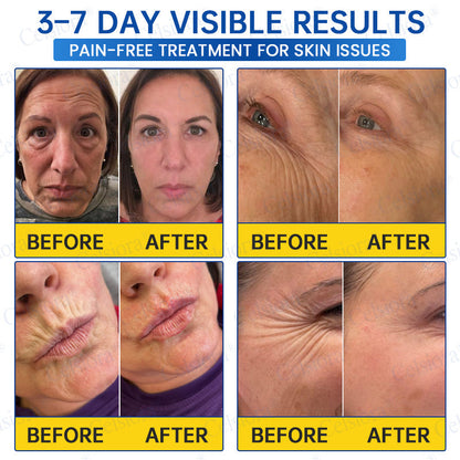 🔵🟦UK HOT SALE Celsiora® PDRN Anti-Wrinkle Shot – Lift & Firming Cream